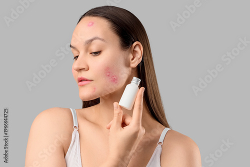 Young woman with acne probl...