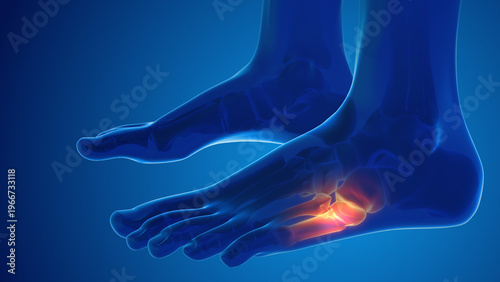 Konstfotografi Broken foot bone pain medical concept