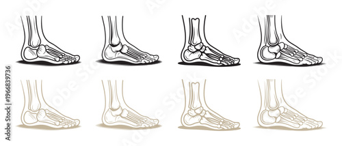 Human Foot Skeletal Anatomy Illustration with Arch Types. Detailed medical diagram of bones on a white background.