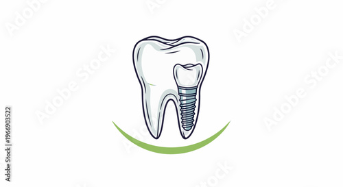 Stylized illustration of a tooth with a dental implant and a green curved line