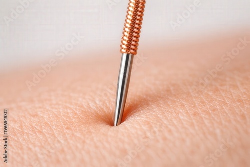 Extreme Macro Acupuncture Needle in Human Skin, Medical Detail of Traditional Therapy Point