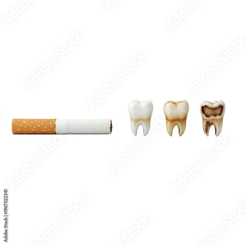 Smoking harms teeth from healthy white to severe decay progression.