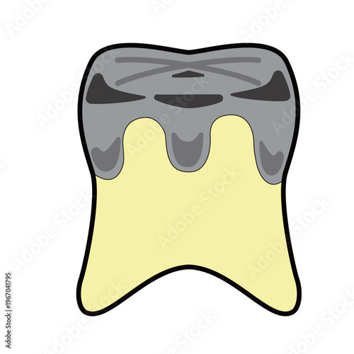 Cute cartoon molar tooth with silver crown and cavity, dental illustration