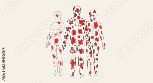 Illustration of three stylized human figures with red patches representing skin conditions