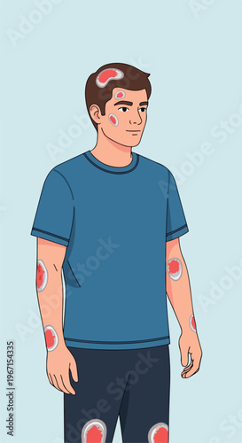 An illustrated man with multiple reddish skin lesions on his body and face area