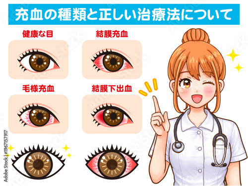 ドライアイの説明をする看護師の女性のアニメ系イラスト素材