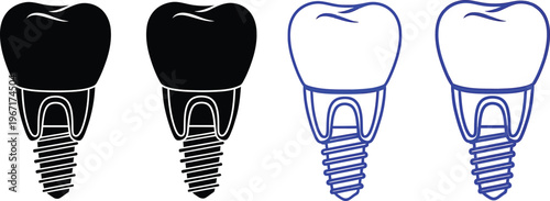 Dental implant icons with four icons representing dental implants are shown