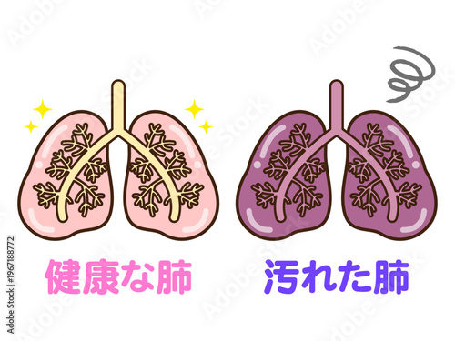 	健康な肺と汚れた肺のイラスト素材3