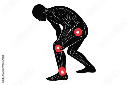 Person in a bent-over position highlighting areas of potential muscle strain or discomfort Vector