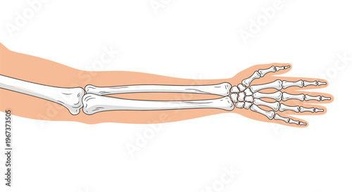 Anatomical illustration showing the bone structure of a human arm including the radius ulna carpals metacarpals and phalanges.