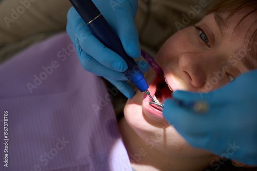 Fotografija Dentist using ultrasonic scaler for patient teeth cleaning