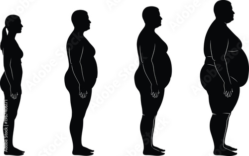 Silhouettes of four people representing different stages of weight gain and obesity levels.