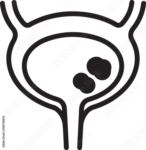 Bladder with Stones Silhouette Vector Illustration Isolated on Transparent urinary organ