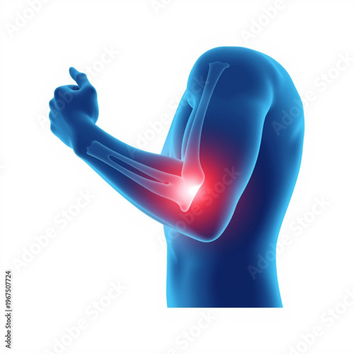 A medical illustration of a human arm with elbow pain highlighted in red