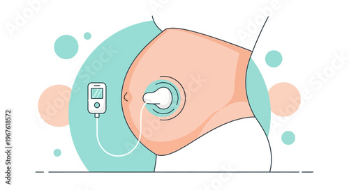 Pregnancy monitoring device attached to pregnant belly, medical technology for fetal health