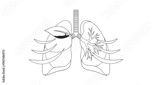 Detailed Illustration of Human Lungs Showing Anatomy and Respiratory System.