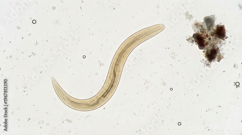 Microscopic View of a Human Parasitic Worm Essential for Medical Diagnosis and Pathology Research
