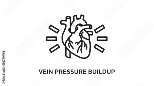 Illustration of a heart with veins and lines indicating pressure buildup, representing cardiovascular health and vein care.
