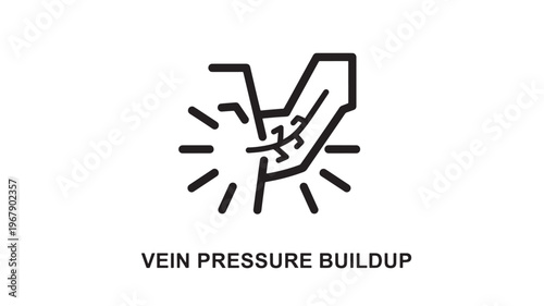 A medical illustration depicting vein pressure buildup, useful for healthcare and circulatory health concepts.