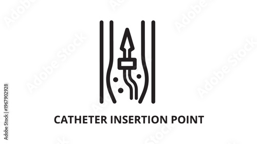 A medical illustration depicting a catheter insertion point, useful for healthcare and medical educational materials, and advertising medical devices.