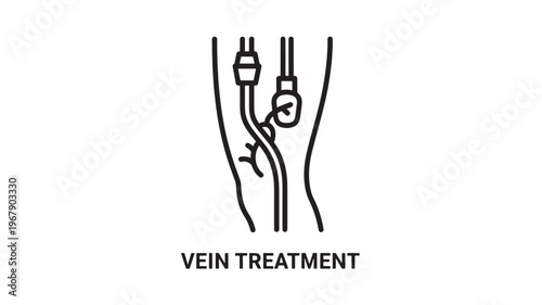 A medical illustration depicting a vein treatment procedure, showing a detailed representation of vascular care and therapy.