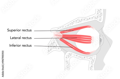 Superior Lateral Inferior rectus - Human eye muscle shown in labeled anatomy chart, controls upward and inward eye movement, important for ocular alignment, medical and educational illustration.
