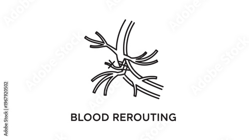 a medical illustration showing blood rerouting through veins, useful for healthcare and medical advertising or educational materials