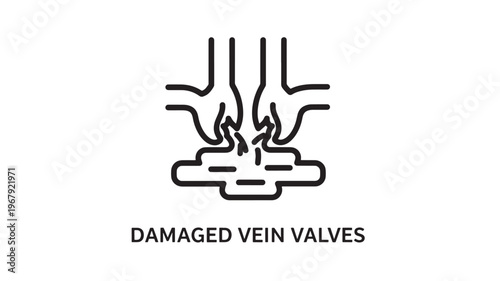 Damaged Vein Valves Line Icon – Venous Insufficiency Medical Illustration Minimal Outline Vector