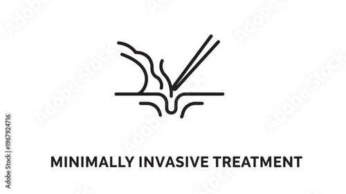 Clean and modern line art illustration depicting a minimally invasive vein treatment procedure. Ideal for healthcare marketing, medical education, vascular surgery brochures, and wellness campaigns.