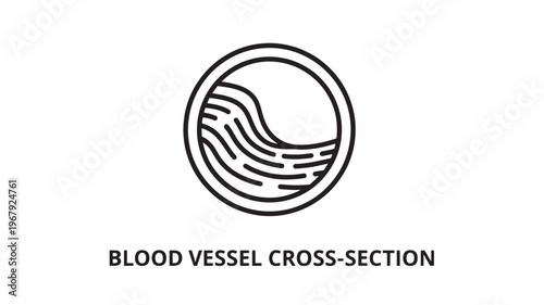 a medical illustration of a blood vessel cross-section, used for educational purposes in healthcare and medicine