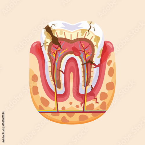 A detailed illustration of a tooth's internal anatomy shows roots, nerves, and enamel, emphasizing oral health, dental care importance, and the complexity of tooth structure.