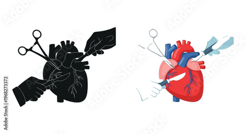 Heart surgery illustration a colorful depiction alongside its silhouette