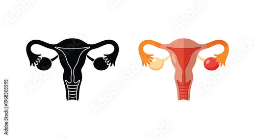 Female reproductive system illustration with detailed color and black silhouette