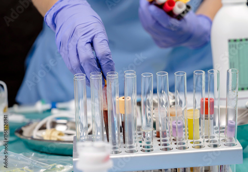 Nurse takes blood samples in a hospital, concept image