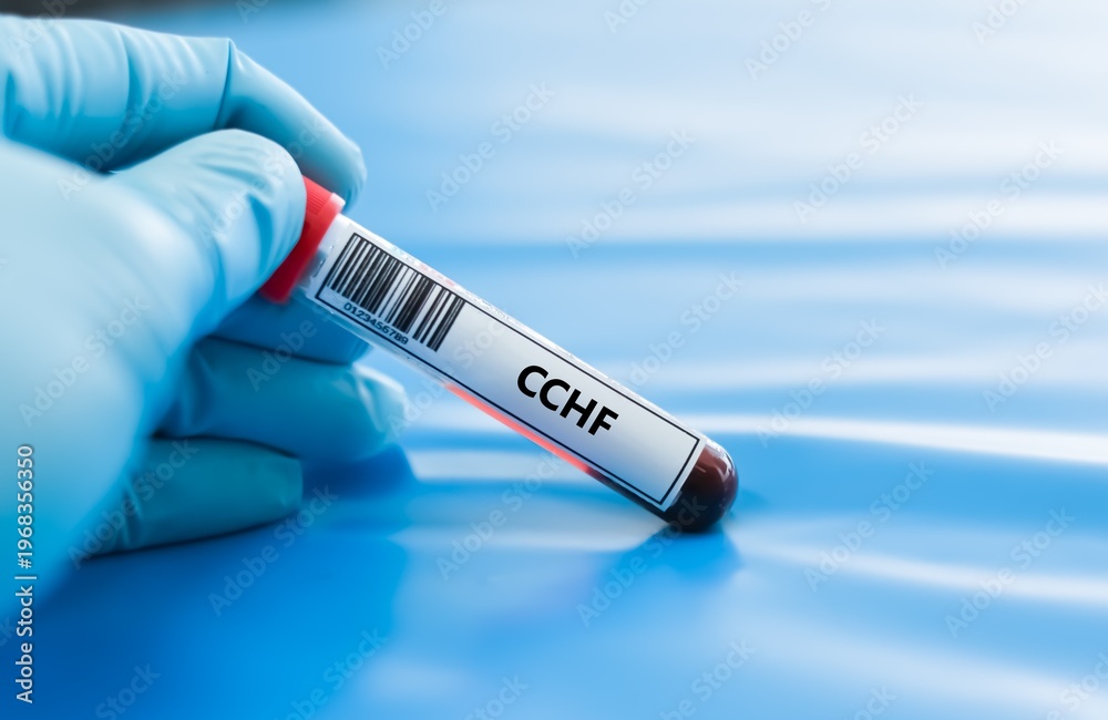 Obraz premium Blood sample tube for CCHF test analysis.