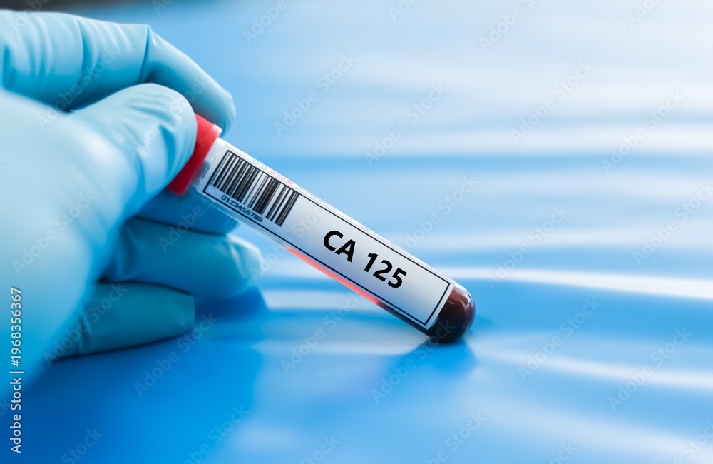 Obraz premium Blood sample tube for CA 125 test analysis.