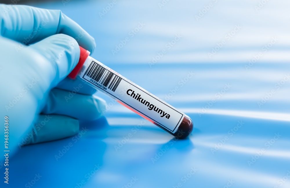 Obraz premium Blood sample tube for chikungunya virus test analysis.