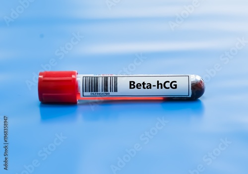 Blood sample tube for beta hcg test analysis.