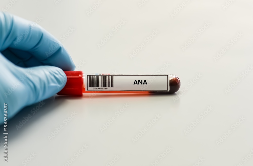 Obraz premium Blood sample tube for anti-nuclear antibody test analysis.