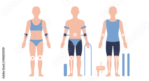 Prosthetic limbs on human body. Vector Icon. EPS Editable