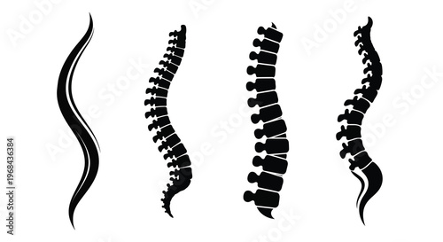 Four spinal curves illustrated as a striking black silhouette