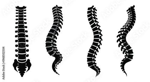 Four spinal columns display varying degrees of curvature a striking silhouette