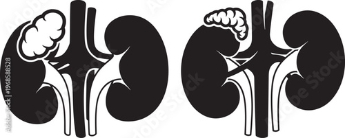 Human kidneys with adrenal glands with adrenal gland with black and white with blood vessel with cross section with internal organ with human body