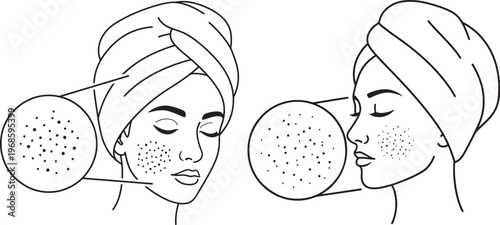 Illustration of a woman with skin blemishes and acne spots with clear skin with szczeg owy with powi kszenie with tr dzik with piel gnacja with pi kno