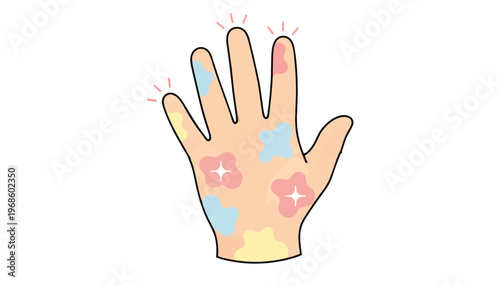 Itchy eczema on a hand concept. Skin allergy and dermatitis symptom. Flat vector illustration isolated on transparent background