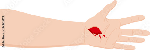 Human arm showing injured palm bleeding cut