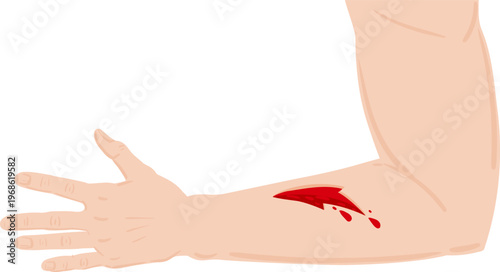 Human arm with deep wound bleeding profusely