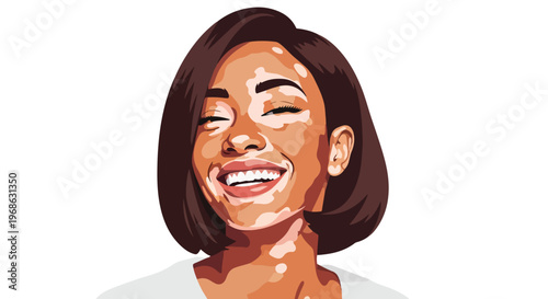 A vector-style illustration of a happy woman with vitiligo smiling brightly