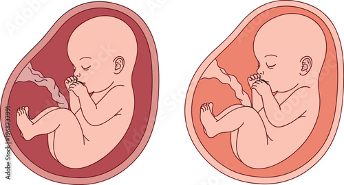 Fetal Development Vector Set with Embryo Stages in Uterus for Medical, Pregnancy, and Science Design Concepts