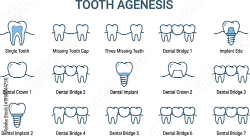 Professional tooth agenesis icon set illustrating dental bridge implants and crown restoration solutions for missing teeth clinical dentistry.